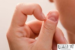 指甲有竖纹是怎么回事？可能与这些原因有关