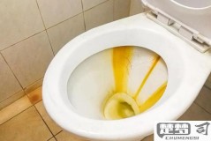 大便粘马桶怎么调理？饮食与生活习惯改善方法全解析