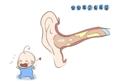 宝宝油耳朵是怎么回事？如何清洁和护理？