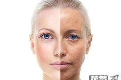 脸粗糙怎么才能变细腻？改善脸部皮肤粗糙的全面指南