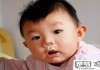 鼻涕发黄是怎么回事？可能是感冒还是鼻窦炎？