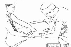 怎么判断是筋出槽了?症状、检查与自我康复全指南