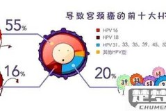 HPV怎么检查出来？检查方法、费用及结果等待时间全解析