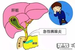 急性胰腺炎怎么引起的？常见病因与预防方法全解析