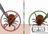 蜱虫叮咬后怎么处理？紧急处理步骤与预防措施全指南