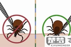 蜱虫叮咬后怎么处理？紧急处理步骤与预防措施全指南