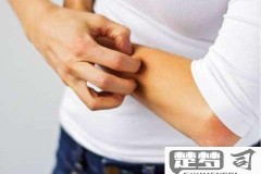身上到处痒是怎么回事？可能的原因和有效治疗方法