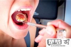 上颚发炎肿痛怎么办？家庭护理与专业治疗方案全解析