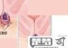 女性肛门瘙痒怎么办？原因与自我护理全指南