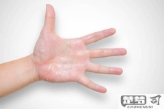 手心脚心热怎么回事?原因与缓解方法全解析