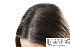 秃头怎么办才能长头发？有效的生发方法全解析