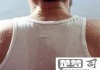后背发热是怎么回事？可能的原因及应对方法