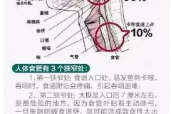 喉咙卡了鱼刺怎么办?快速取出与正确急救方法