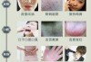 怎么判断湿气往外排出？湿气往外排出的症状有哪些？