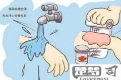 被开水烫了怎么处理？快速有效的急救与护理指南