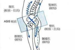 骨盆前倾是怎么造成的？原因、症状及矫正方法全解析