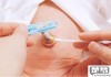新生儿脐带怎么消毒？正确方法与护理指南
