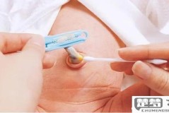 新生儿脐带怎么消毒？正确方法与护理指南
