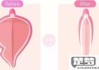 阴唇发黑怎么能变粉色？科学方法与自然护理全解析