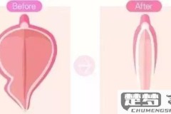 阴唇发黑怎么能变粉色?科学方法与自然护理全解析