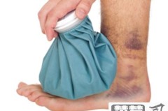 崴脚了怎么快速恢复?科学分阶段处理方案全解析