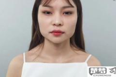 国字脸怎么改变脸型？医学美容与自然方法全解析
