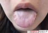 舌头有齿痕怎么调理？中医推荐健脾祛湿的饮食与生活方式