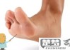 脚前掌疼是怎么回事？可能原因及缓解方法全解析