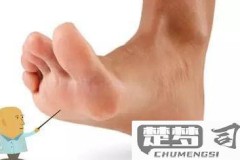 脚前掌疼是怎么回事？可能原因及缓解方法全解析