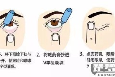 眼药水怎么滴才正确？详细步骤与注意事项
