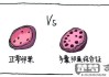 多囊卵巢综合症怎么办？综合治疗与自然疗法全解析