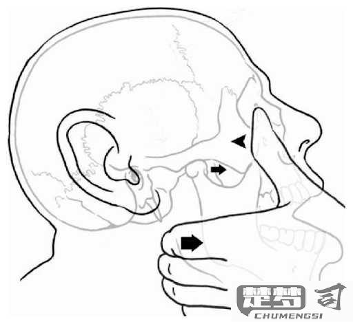 下巴脱臼怎么办自救？正确步骤与预防方法全解析