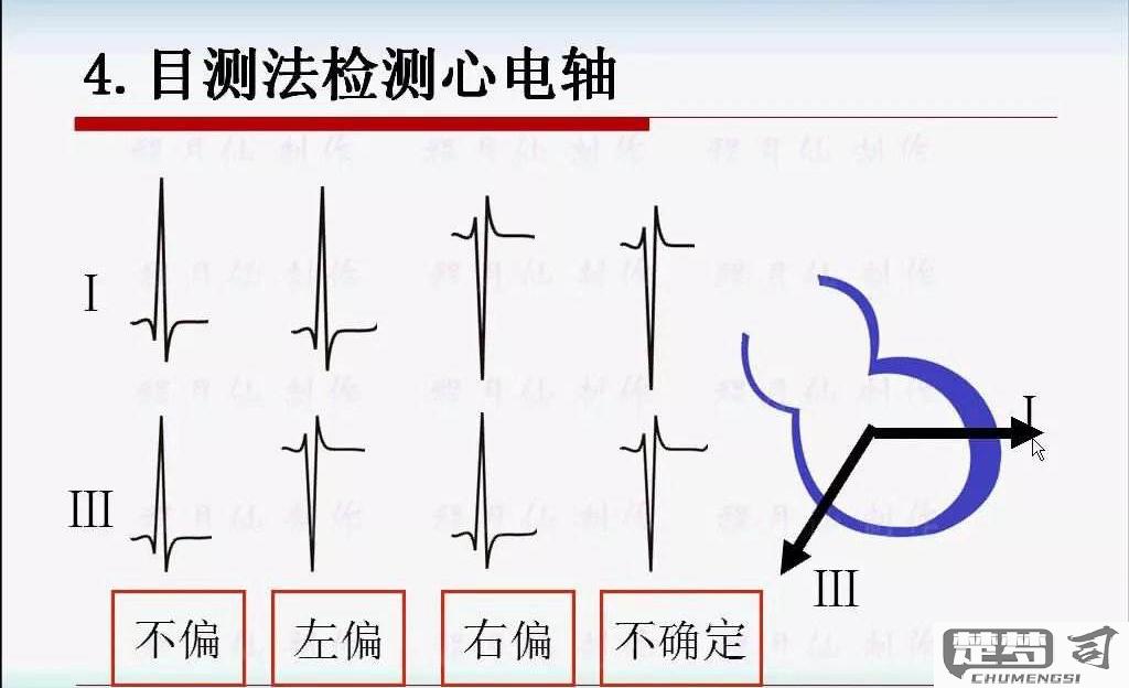心电轴右偏怎么回事？原因、检查与治疗方法全解析