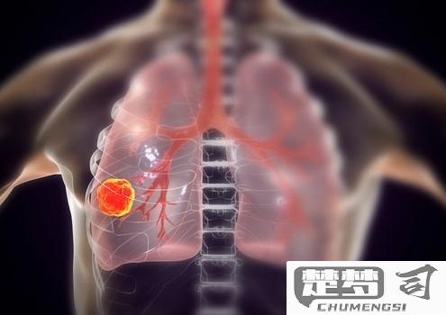 肺部有肿瘤怎么治疗？全面解析治疗方案与注意事项