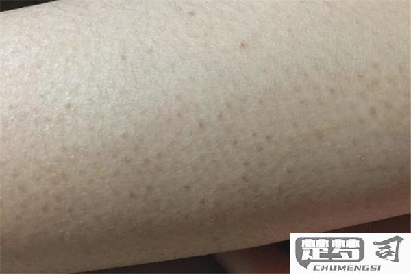 毛周角化症怎么去除？有效方法与自然疗法全解析