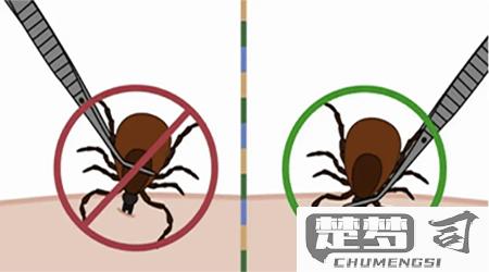 蜱虫叮咬后怎么处理？紧急处理步骤与预防措施全指南