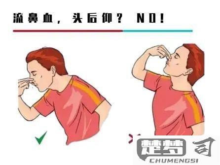 流鼻血怎么止血最快？家庭常用方法及频繁流鼻血的可能原因