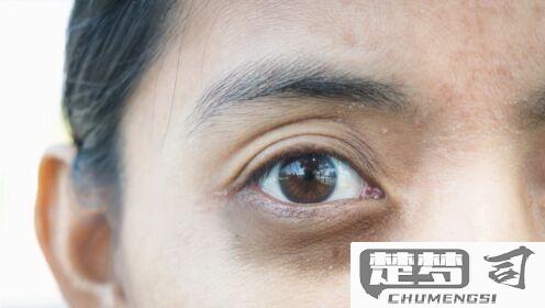 眼圈发黄是怎么回事？可能的原因和改善方法