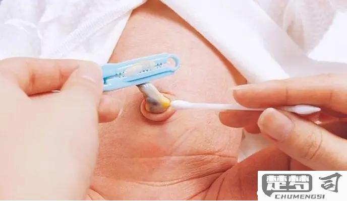 新生儿脐带怎么消毒？正确方法与护理指南