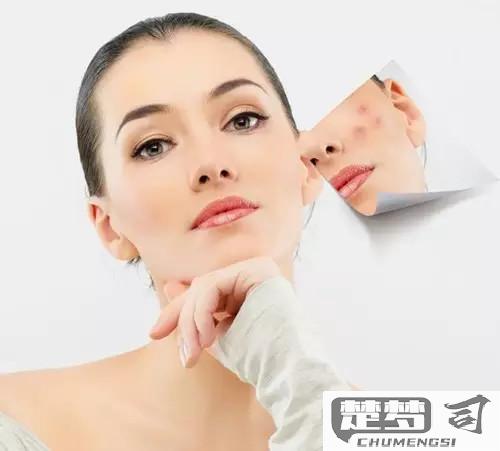粉刺型痘痘怎么去除？有效的清洁控油与自然疗法全攻略