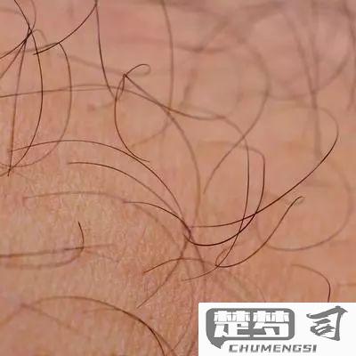 女生体毛过多怎么办？科学处理与自然减少方法全解析