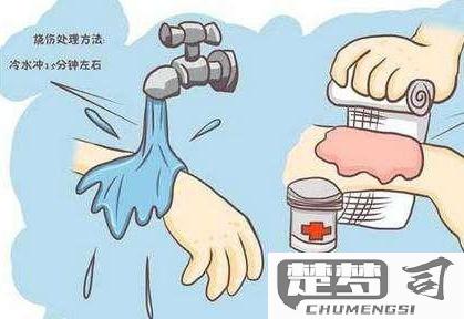 被开水烫了怎么处理？快速有效的急救与护理指南