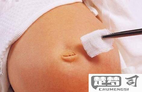 新生儿肚脐怎么护理？正确步骤和注意事项全解析