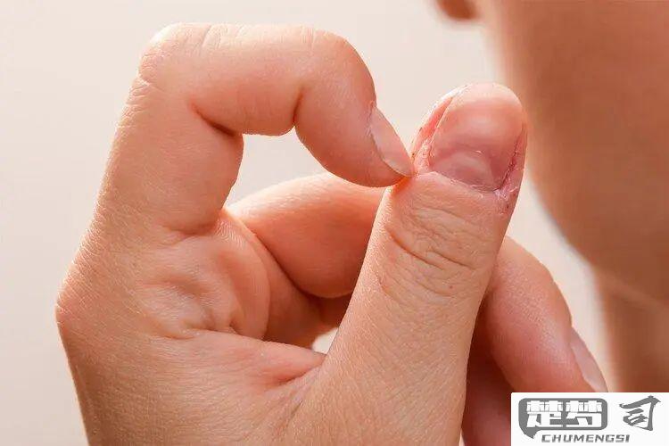 指甲有竖纹是怎么回事？可能与这些原因有关