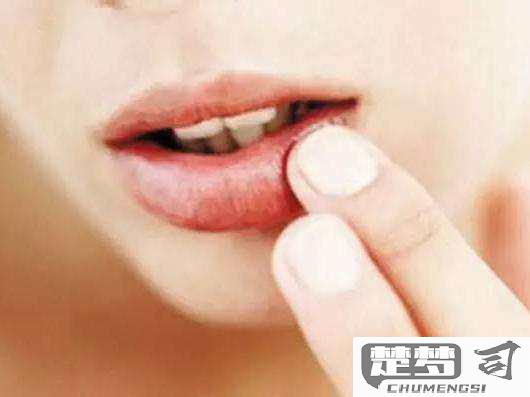 嘴上起泡怎么快速消除？实用方法与家庭疗法全解析