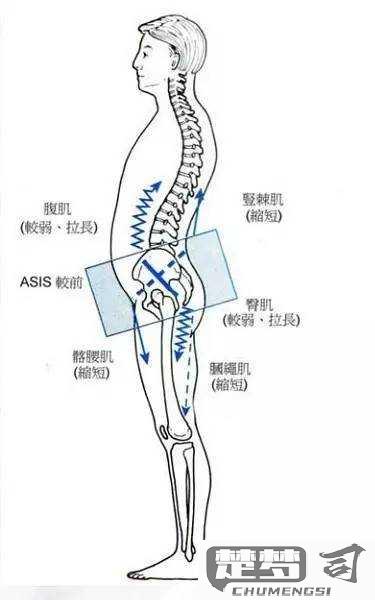 骨盆前倾是怎么造成的？原因、症状及矫正方法全解析