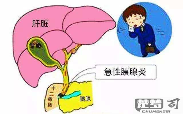 急性胰腺炎怎么引起的？常见病因与预防方法全解析