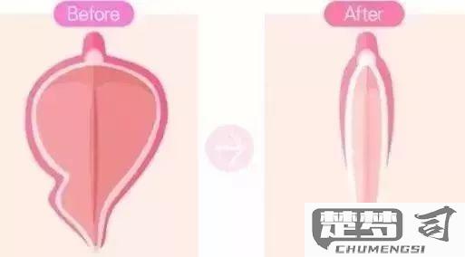 阴唇发黑怎么能变粉色？科学方法与自然护理全解析