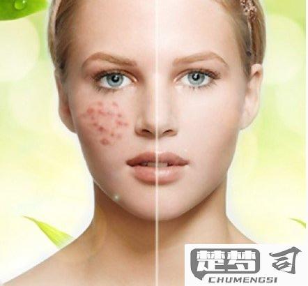脸上痘印怎么最快淡化？专业护肤与医美方案全解析