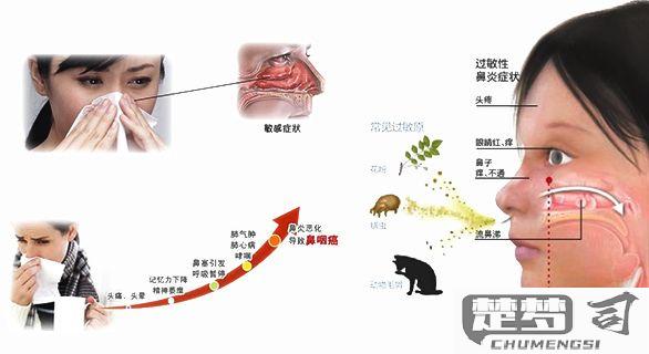 过敏性鼻炎是怎么引起的？全面解析病因、预防与治疗